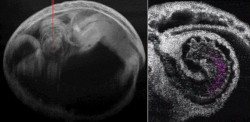 Desarrollan en el laboratorio un organoide que reproduce un coraz&oacute;n embrionario