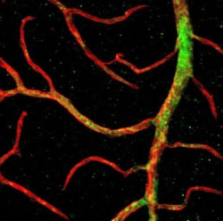 Desarrollan la primera tecnolog&iacute;a endovascular que puede explorar capilares