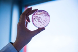 Desarrollan una `E. coli` sint&eacute;tica reprogramada que presenta gran resistencia viral