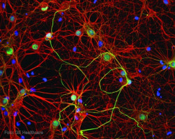 Descubren un gen protector del Alzheimer y desarrollan una plataforma r&aacute;pida de pruebas para f&aacute;rmacos