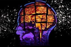 Descubren una prote&iacute;na involucrada en la eliminaci&oacute;n de la acumulaci&oacute;n de Alzheimer