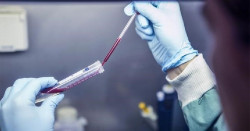 El an&aacute;lisis de sangre es una nueva herramienta potencial para controlar las infecciones