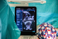 El c&aacute;ncer de pr&oacute;stata "sigue siendo un tema tab&uacute;", pese a los 35.000 casos anuales en Espa&ntilde;a, advierte un experto