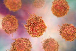 El c&aacute;ncer de pr&oacute;stata utiliza un interruptor metab&oacute;lico para prosperar despu&eacute;s de la terapia hormonal