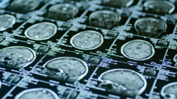 El cerebro puede ser un nuevo objetivo terap&eacute;utico para mejorar la respiraci&oacute;n tras una lesi&oacute;n pulmonar por covid-19