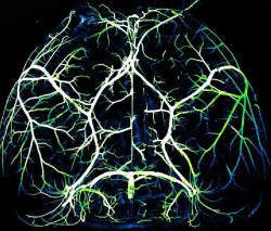 El tejido cerebral da pistas sobre las causas del trastorno de estr&eacute;s postraum&aacute;tico