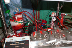 En busca de la sangre perdida, por el Dr. José Manuel Revuelta Soba