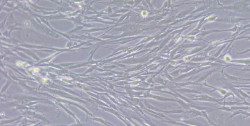 Fibroblastos act&uacute;an como escudo en c&aacute;ncer de v&iacute;as biliares intrahep&aacute;tico para resistir a quimioterapia, seg&uacute;n un estudio