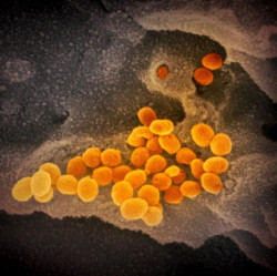 Gran preocupaci&oacute;n en el mundo cient&iacute;fico y en la OMS con la variante sudafricana OMICRON y su riesgo de reinfecci&oacute;n"