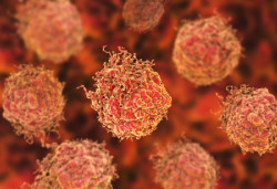 Hallan nuevas pistas sobre el c&aacute;ncer de pr&oacute;stata que revelan por qu&eacute; el subtipo agresivo puede resistir el tratamiento