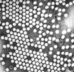 Identifican anticuerpos protectores para enfermedades raras similares a la polio en ni&ntilde;os