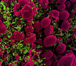 Identifican un f&aacute;rmaco ya existente que inhibe el coronavirus