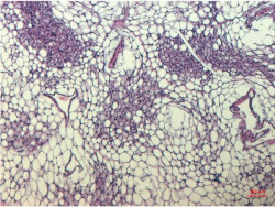 Identifican una mol&eacute;cula que potencia la quema de grasa