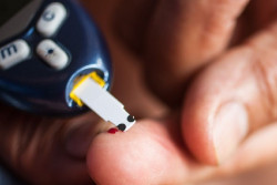 Identifican variantes gen&eacute;ticas raras confieren el mayor aumento del riesgo de diabetes tipo 2 observado hasta la fecha