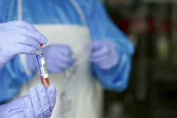  Illa destaca que las CCAA ya han hecho m&aacute;s de 2,5 millones de PCR y m&aacute;s de 1,5 millones de test r&aacute;pidos