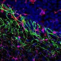 Investigadores del CNIO hallan una v&iacute;a para aumentar la eficacia de la radioterapia contra las met&aacute;stasis cerebrales
