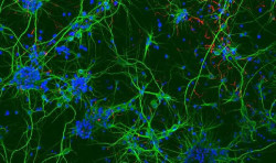 Investigadores del CSIC crean un hidrogel que permite cultivar c&eacute;lulas neurales para reparar lesiones medulares