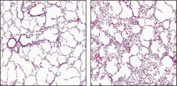 Investigadores revierten el enfisema en ratones inyectando c&eacute;lulas de la pared de los vasos sangu&iacute;neos
