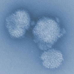 Investigadores trabajan en una estrategia de vacunas que podr&iacute;an proteger contra cualquier virus de la gripe