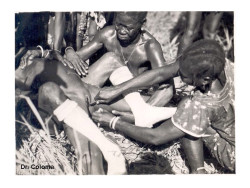 La ablaci&oacute;n de nuevo