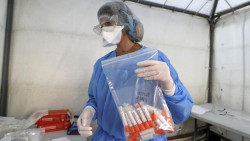 La France renforce ses capacit&eacute;s de tests du coronavirus