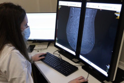 La tomos&iacute;ntesis digital de mama reduce la tasa de c&aacute;nceres de intervalo
