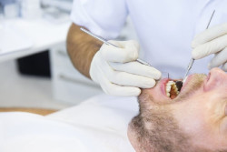 Las bacterias que causan caries forman un `ej&eacute;rcito` defensivo de microbios en los dientes