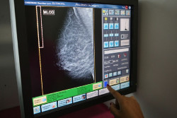 Las supervivientes de c&aacute;ncer de mama tienen menos probabilidades de quedar embarazadas pero suelen tener beb&eacute;s sanos