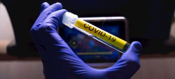  Los nuevos casos de Covid-19 se elevan a 257 en las &uacute;ltimas 24 horas