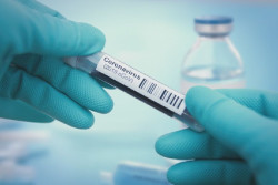  Sanidad actualiza los datos y contabiliza 28.313 fallecidos en Espa&ntilde;a hasta el jueves