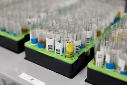 Sanidad confirma 142 casos positivos de viruela del mono en Espa&ntilde;a