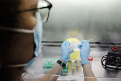 Sanidad confirma 198 casos positivos de viruela del mono y otros 402 sospechosos en Espa&ntilde;a