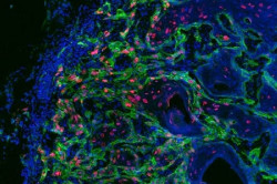 Un estudio revela un nuevo aspecto de la evoluci&oacute;n tumoral y posibles dianas terap&eacute;uticas