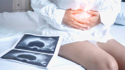 Un estudio vincula el c&aacute;ncer de ovario con la colonizaci&oacute;n bacteriana en el microbioma