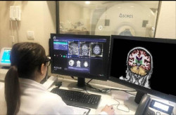 Una combinaci&oacute;n particular de microorganismos en el intestino puede empeorar los s&iacute;ntomas de esclerosis m&uacute;ltiple