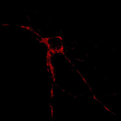 Una enzima mitocondrial que bloquea la v&iacute;a de la muerte celular apunta a una nueva estrategia de tratamiento del c&aacute;ncer